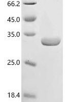 Human Lon protease homolog 2, peroxisomal (LONP2), partial Recombinant Protein - BioCrest Sci