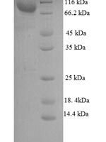 Mouse WD repeat-containing and planar cell polarity effector protein fritz homolog (Wdpcp) Recombinant Protein - BioCrest Sci