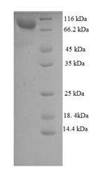 Mouse WD repeat-containing and planar cell polarity effector protein fritz homolog (Wdpcp) Recombinant Protein, Mus musculus (Mouse), E.coli, N-terminal GST-tagged, 108.7 kDa, purity >≥ 90% as determined by SDS-PAGE.