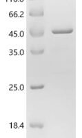 Human Interferon alpha-14 (IFNA14) Recombinant Protein, N-GST - BioCrest Sci
