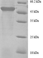 Human 40S ribosomal protein S9 (RPS9), partial Recombinant Protein - BioCrest Sci