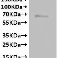 Mouse Transient receptor potential cation channel subfamily V member 6 (Trpv6)-VLPs Recombinant Protein - BioCrest Sci