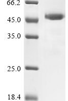 Rat Mannose-binding protein C (Mbl2) Recombinant Protein - BioCrest Sci