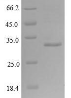 Human/Cynomolgus monkey Activin receptor type-2B (ACVR2B), partial Recombinant Protein, N-His-B2M - BioCrest Sci