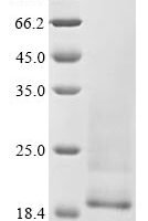 Canine distemper virus Nucleoprotein (N), partial Recombinant Protein - BioCrest Sci