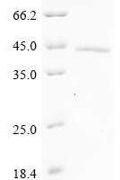Human Secreted frizzled-related protein 2 (SFRP2), partial Recombinant Protein - BioCrest Sci