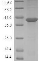 Human Activating signal cointegrator 1 complex subunit 3 (ASCC3) Recombinant Protein, N-GST - BioCrest Sci