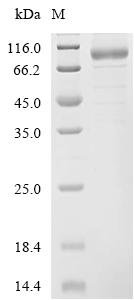 Human Thyrotropin receptor (TSHR), partial Recombinant Protein, C-hFc1, aa 21–310, Homo sapiens (Human), Mammalian cell, C-terminal hFc1-tagged, 64.0 kDa, purity >≥ 85% as determined by SDS-PAGE.