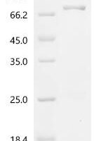 Human Long-chain-fatty-acid--CoA ligase 1 (ACSL1), partial Recombinant Protein - BioCrest Sci