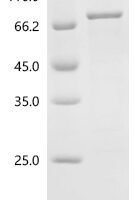 Human YTH domain-containing family protein 1 (YTHDF1) Recombinant Protein - BioCrest Sci