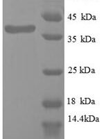 Human Wilms tumor protein (WT1), partial Recombinant Protein - BioCrest Sci