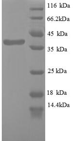 Human Wilms tumor protein (WT1), partial Recombinant Protein, Homo sapiens (Human), E.coli, N-terminal 6xHis-tagged, 38.2 kDa, purity >≥ 90% as determined by SDS-PAGE.
