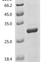 Mouse Bone morphogenetic protein 6 (Bmp6) Recombinant Protein, N-His/C-His - BioCrest Sci