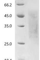 Human Tumor necrosis factor receptor superfamily member 25 (TNFRSF25), partial Recombinant Protein, N-His, aa 25–199, Yeast - BioCrest Sci