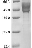 Human Interleukin-13 (IL13), partial Recombinant Protein - BioCrest Sci