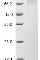 Mouse Nidogen-2 (Nid2), partial Recombinant Protein - BioCrest Sci