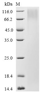 Mouse Nidogen-2 (Nid2), partial Recombinant Protein, Mus musculus (Mouse), Yeast, C-terminal 6xHis-tagged, 41.0 kDa, purity >≥ 90% as determined by SDS-PAGE.