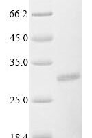 Rotavirus A Non-structural glycoprotein 4, partial Recombinant Protein, N-His/C-Myc - BioCrest Sci