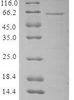 Human parvovirus B19 Minor capsid protein VP1, partial Recombinant Protein, N-10His/C-Myc - BioCrest Sci