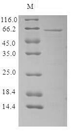 Human parvovirus B19 Minor capsid protein VP1, partial Recombinant Protein, N-10His/C-Myc, Human parvovirus B19 (isolate AU) (HPV B19), Baculovirus, N-terminal 10xHis-tagged and C-terminal Myc-tagged, 64.8 kDa, purity >≥ 85% as determined by SDS-PAGE.