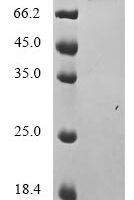 Influenza A virus Hemagglutinin (HA), partial Recombinant Protein, C-hFc1 - BioCrest Sci