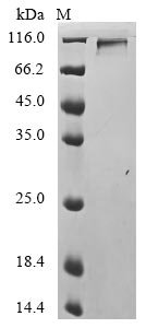 Influenza A virus Hemagglutinin (HA), partial Recombinant Protein, C-hFc1, Influenza A virus, Mammalian cell, C-terminal hFc1-tagged, 86.4 kDa, purity >≥ 90% as determined by SDS-PAGE.