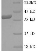Human Eukaryotic translation initiation factor 4 gamma 1 (EIF4G1), partial Recombinant Protein, N-His - BioCrest Sci