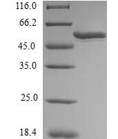 Human Homeobox protein MOX-1 (MEOX1) Recombinant Protein - BioCrest Sci