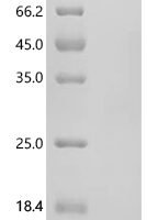Human Protein ADM2 (ADM2), partial Recombinant Protein, N-10His - BioCrest Sci