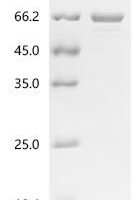 Mycobacterium tuberculosis NAD(P)H dehydrogenase (quinone) (lpdA) Recombinant Protein, C-His - BioCrest Sci
