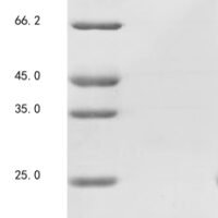 Cyprinus carpio Granulin-3 Recombinant Protein - BioCrest Sci