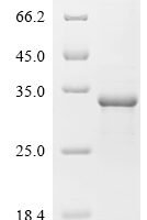 Bovine Chymotrypsin-like elastase family member 2A (CELA2A) Recombinant Protein - BioCrest Sci