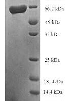 Human Succinate-semialdehyde dehydrogenase, mitochondrial (ALDH5A1) Recombinant Protein, N-His-SUMO - BioCrest Sci
