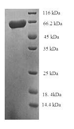 Human Succinate-semialdehyde dehydrogenase, mitochondrial (ALDH5A1) Recombinant Protein, N-His-SUMO, Homo sapiens (Human), E.coli, N-terminal 6xHis-SUMO-tagged, 68.3 kDa, purity >≥ 90% as determined by SDS-PAGE.