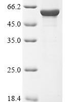 Human Keratin, type I cytoskeletal 16 (KRT16) Recombinant Protein - BioCrest Sci