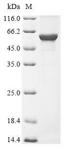 Human Keratin, type I cytoskeletal 16 (KRT16) Recombinant Protein, Homo sapiens (Human), E.coli, N-terminal 10xHis-tagged and C-terminal Myc-tagged, 58.7 kDa, purity >≥ 85% as determined by SDS-PAGE.