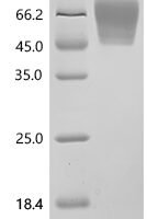 Mouse Trophoblast glycoprotein (Tpbg), partial Recombinant Protein - BioCrest Sci