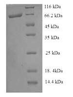 Escherichia coli Pyruvate dehydrogenase [ubiquinone] (poxB) Recombinant Protein - BioCrest Sci