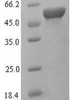 Rat Kynurenine 3-monooxygenase (Kmo), partial Recombinant Protein - BioCrest Sci