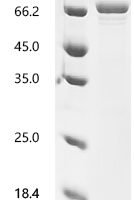 Human Dihydrolipoyllysine-residue acetyltransferase component of pyruvate dehydrogenase complex, mitochondrial (DLAT), partial Recombinant Protein, C-His - BioCrest Sci