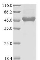 Human Breast cancer metastasis-suppressor 1-like protein (BRMS1L) Recombinant Protein - BioCrest Sci