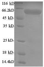 Mouse Uncharacterized aarF domain-containing protein kinase 2 (Adck2), partial Recombinant Protein, N-His-tagged/Tag-Free, Mus musculus (Mouse), Yeast, N-terminal His-tagged/Tag-Free, 47.4 kDa, purity >≥ 90% as determined by SDS-PAGE.
