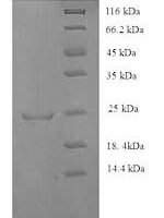 Human HLA class II histocompatibility antigen, DQ alpha 1 chain (HLA-DQA1), partial Recombinant Protein - BioCrest Sci