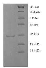 Human HLA class II histocompatibility antigen, DQ alpha 1 chain (HLA-DQA1), partial Recombinant Protein, Homo sapiens (Human), E.coli, N-terminal 6xHis-tagged, 25.4 kDa, purity >≥ 90% as determined by SDS-PAGE.