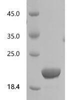 Human Chymotrypsinogen B2 (CTRB2) Recombinant Protein, C-His - BioCrest Sci
