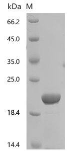 Human Chymotrypsinogen B2 (CTRB2) Recombinant Protein, C-His, Homo sapiens (Human), Homo sapiens (Human), C-terminal 6xHis-tagged, 27.4 kDa, purity >≥ 85% as determined by SDS-PAGE.