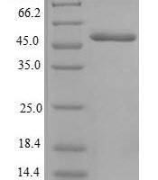 Human Centromere protein H (CENPH) Recombinant Protein - BioCrest Sci