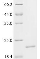 Drosophila melanogaster Profilin (chic) Recombinant Protein, C-His - BioCrest Sci
