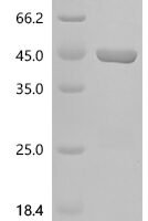 Human Superoxide dismutase [Mn], mitochondrial (SOD2) Recombinant Protein, N-GST - BioCrest Sci