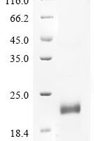 Bovine Cation-independent mannose-6-phosphate receptor (IGF2R), partial Recombinant Protein, C-His - BioCrest Sci